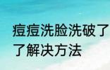 痘痘洗脸洗破了怎么办 痘痘洗脸洗破了解决方法