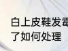 白上皮鞋发霉了怎么办 白上皮鞋发霉了如何处理