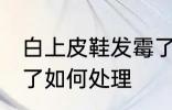 白上皮鞋发霉了怎么办 白上皮鞋发霉了如何处理